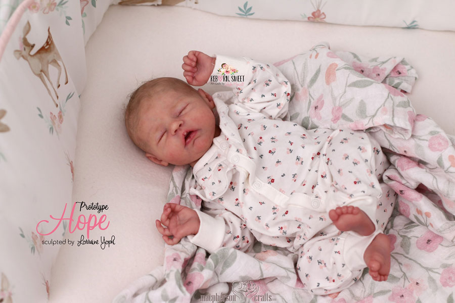 Hope asleep by Lorraine Yophi