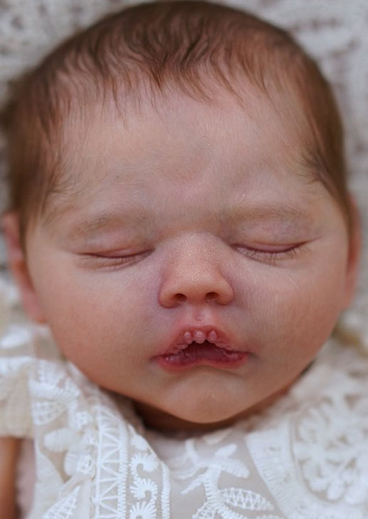 Miracle by Lorraine Yophi